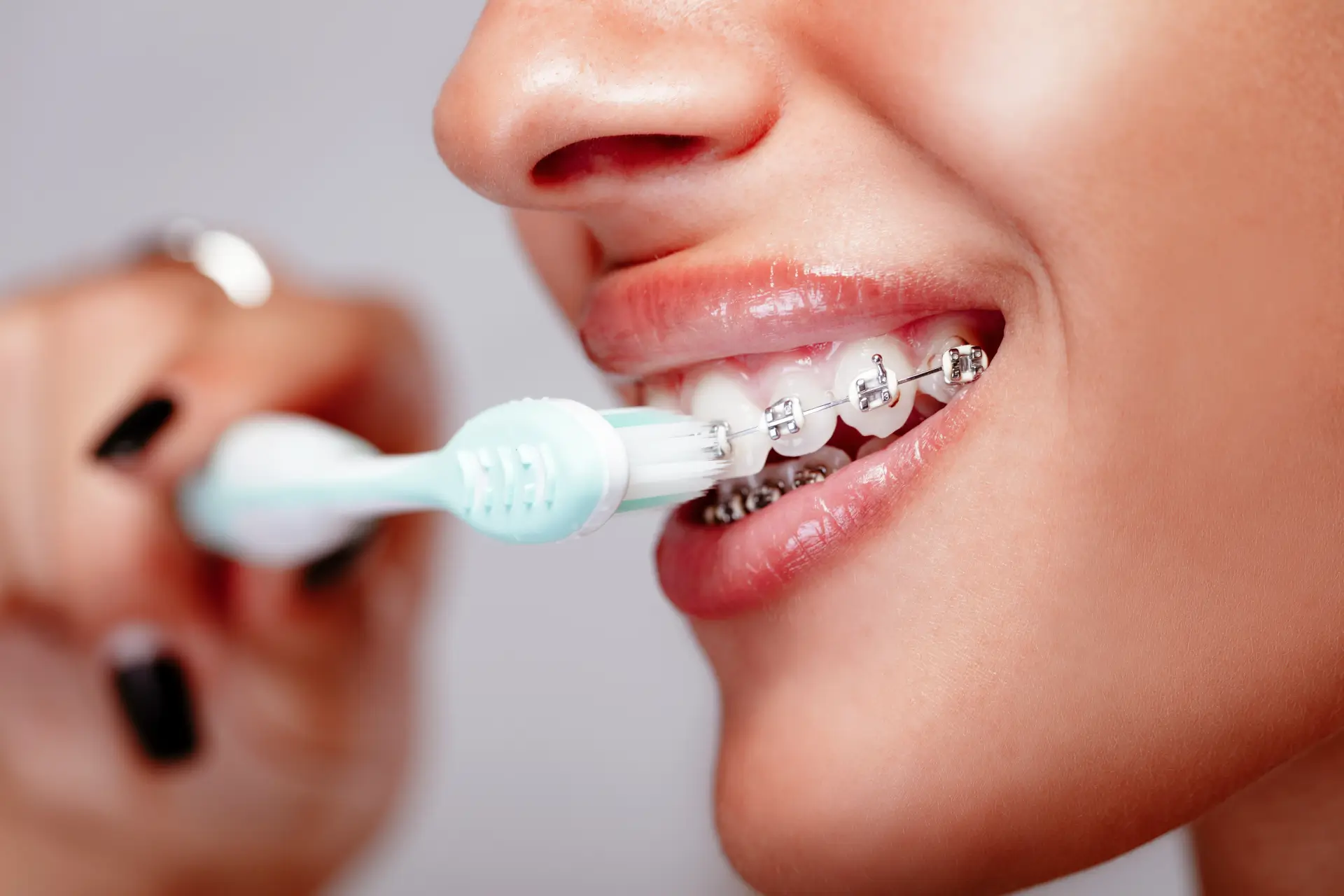 Maintaining-Oral-Hygiene-Braces-Blog